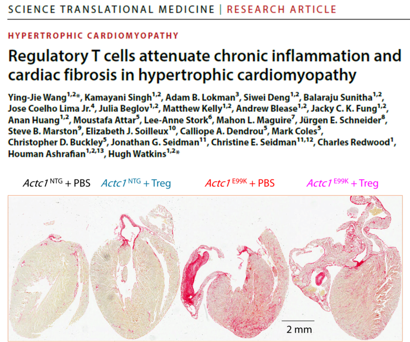 CureHeart researchers publish new study on heart scaring in cardiomyopathy  